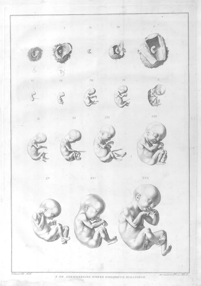 soemmerring_plate